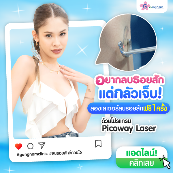 โปรแกรมPicowayLaserลบรอยสัก