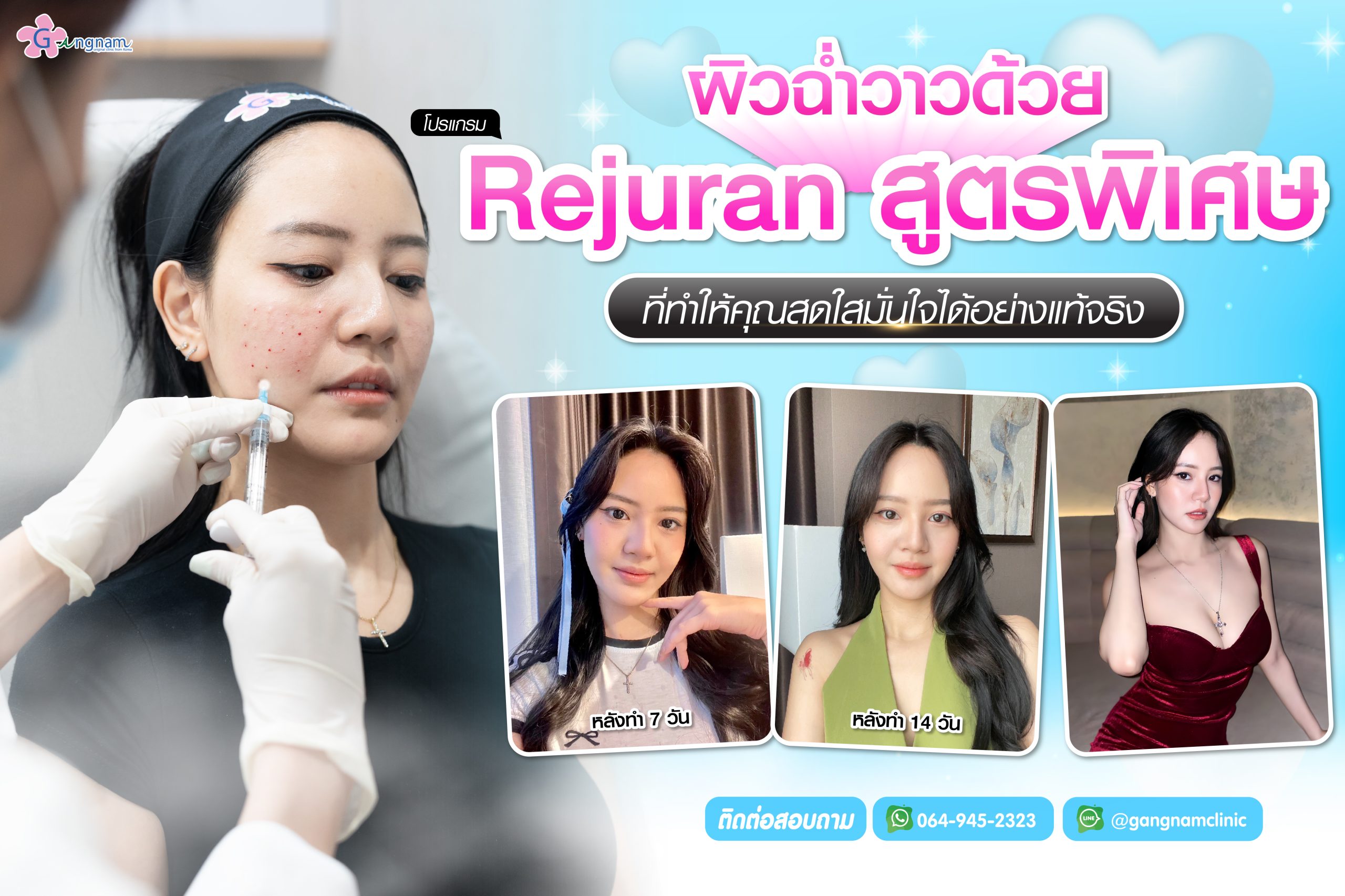 โปรแกรมrejuran สูตรพิเศษ